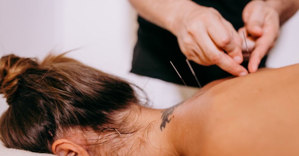 Close-up of acupuncture needles being inserted on a woman's back during therapy, promoting relaxation and wellness.